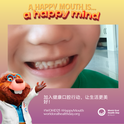 f28659fd0cde3e8b51f6bc2fa50b3e93.png